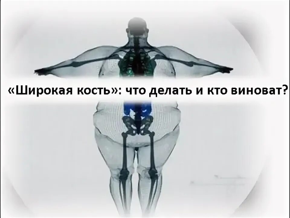 У меня кость широкая картинка. Широкая кость. Люди с широкой костью. Скелет с широкой костью. Кость тяжелая правда.