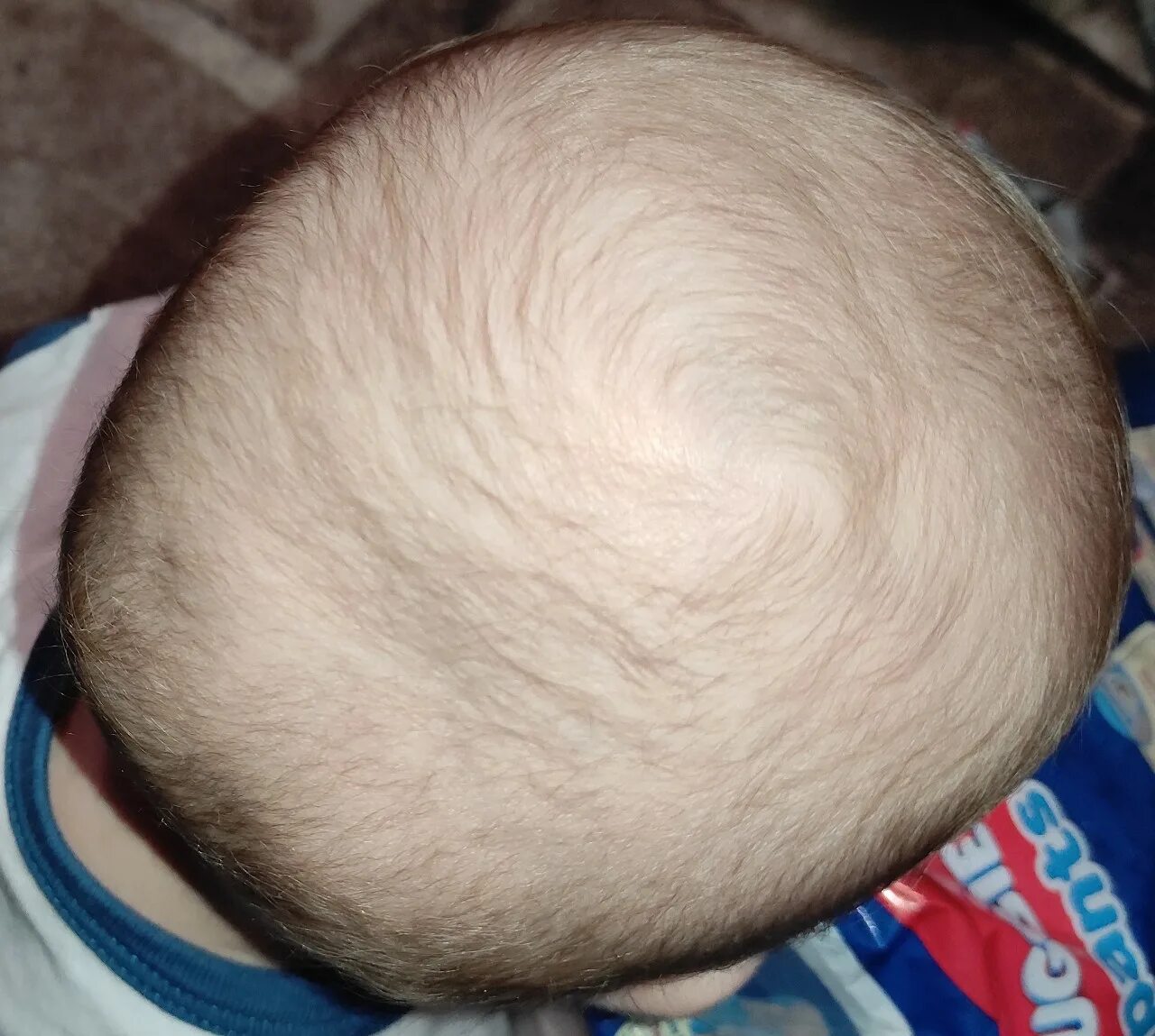Неровная форма головы у ребенка.
