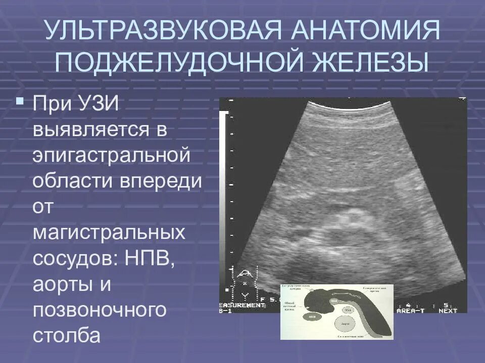 Норма узи поджелудочной железы у мужчин. УЗИ анатомия поджелудочной железы. Изранов лекции по УЗИ поджелудочной железы. Фуци поджелудочной железы. Поджелудочная железа на УЗД.