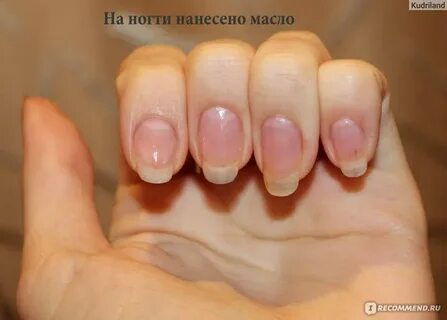 Пустота между ногтям