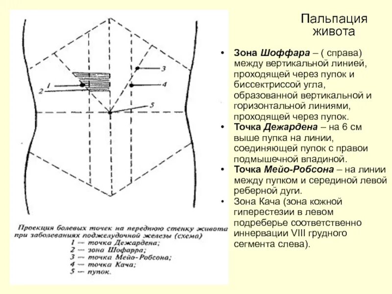 Точки болезненности. Точка Дежардена и Мейо-Робсона. Точка Шоффара и Дежардена зона Мейо-Робсона. Точка Дежардена, точка Мейо-Робсона. Точка Кера Мейо Робсона.