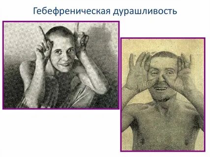 Частная шизофрения