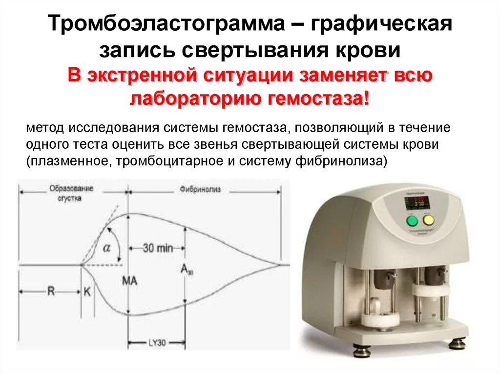 Тест определяющий скорость. Тромбоэластография тромбоэластограмма. Тромбоэластограмма расшифровка показателей. Тромбоэластография интерпретация тромбоэластограммы. Тромбоэластограмма алгоритм оценки.