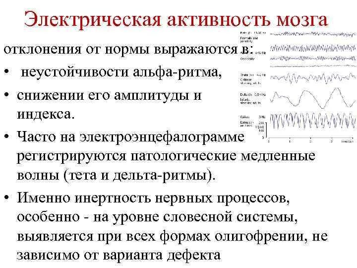 О чем говорит ээг. Расшифровка показателей электроэнцефалограммы ЭЭГ головного мозга. ЭЭГ расшифровка ритмы норма. Альфа ритма ЭЭГ норма показателей. Альфа ритм на ЭЭГ норма.