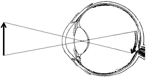 Аккомодация рисунок. Редуцированный глаз Вербицкого. Изображение строится на сетчатке. Аккомодация глаза. Построение изображения на сетчатке.