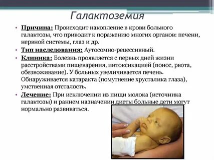 Инфекции у новорожденных клинические