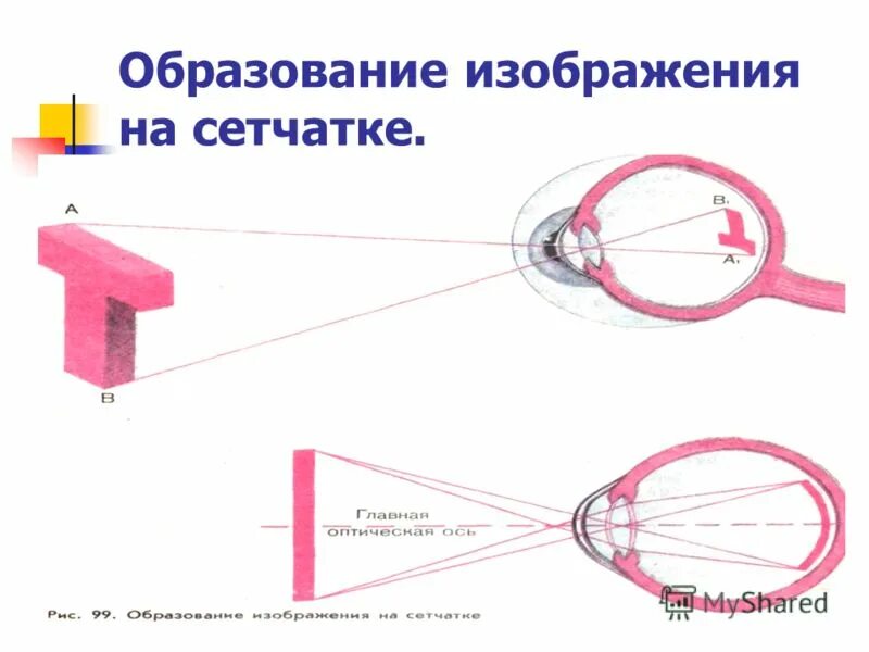Изображение предмета на сетчатке. Какое изображение образуется на сетчатке. Какое изображение образуется на сетчатке. Построение изображения на сетчатке в нормальном глазу. Построение образа на сетчатке.