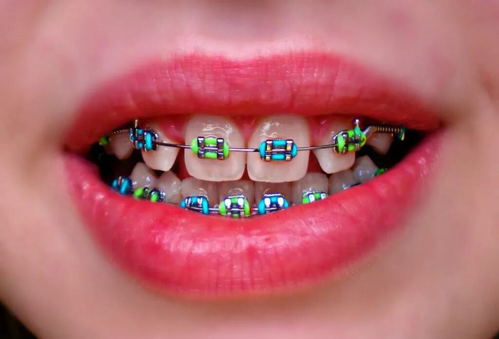 Brackets 2025