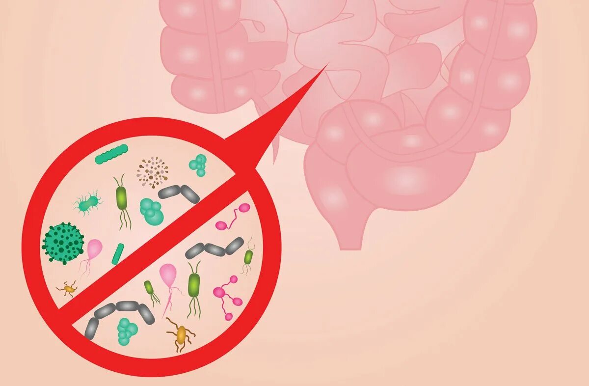 Кишечная палочка вызывает заболевания. Кишечные бактерии. Микробы вызывающие цистит. Микробы в кишечнике.