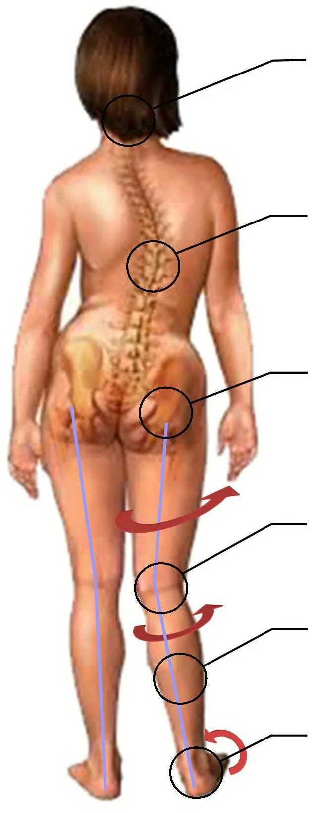 Болит внизу спины ногу. Искривление позвоночника. Искривление спины и таза. Позвоночник копчик.