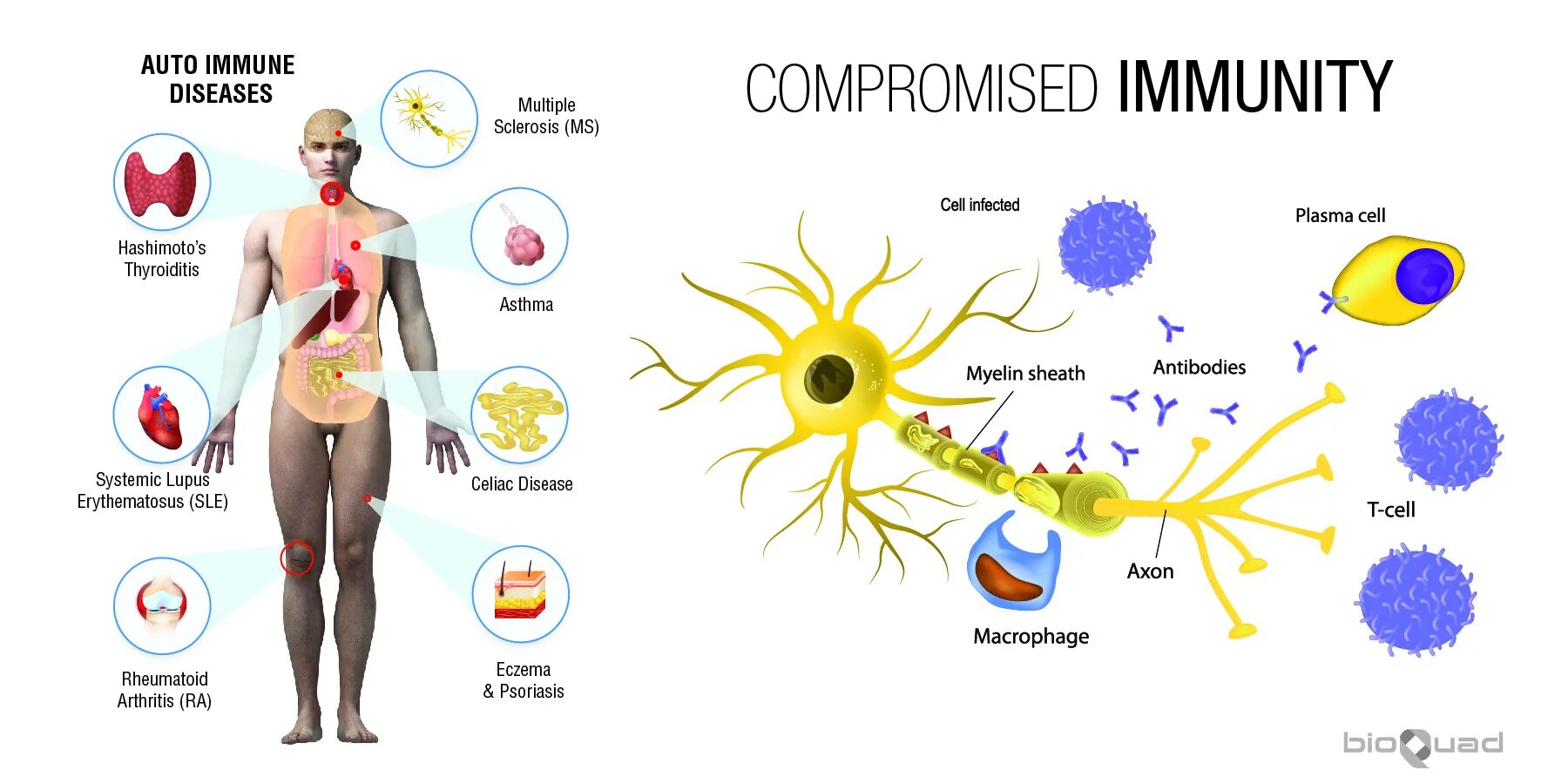 Иммунная система человека. Immune disease. Обкуренная иммунная система. Иммунный глаз