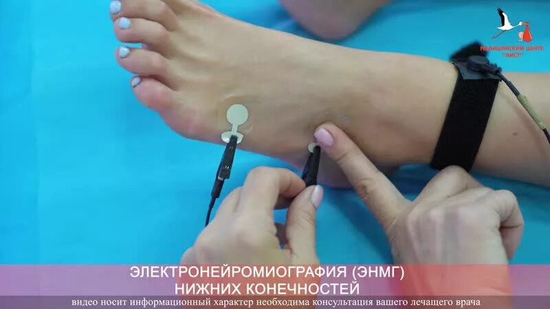 Энмг нижних конечностей. Электронейромиография. Энмг нижних конечностей в воронеже. Энмг верхних конечностей и нижних конечностей. Стимуляционная энмг нижних конечностей.