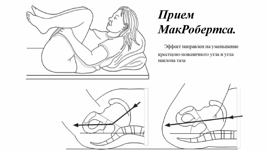 Мак робертса