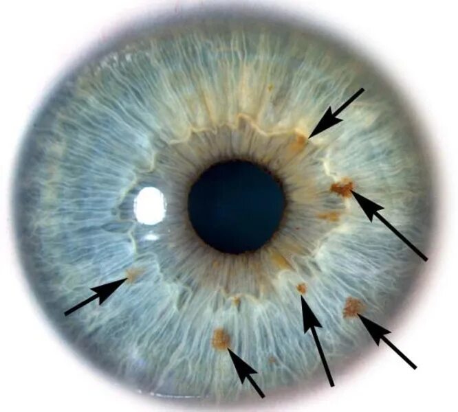 функции радужки и зрачка. что означает радужка глаза. иридодиагностика атлас. зрачок глаза. что означает радужка глаза.