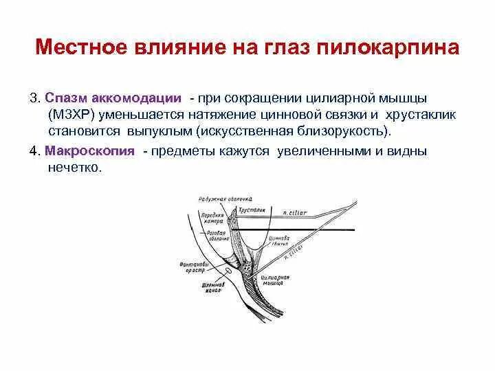 Механизм действия пилокарпина на глаз. Влияние пилокарпина на глаз. При сокращении цилиарной мышцы. Влияние м холиномиметиков на глаз.