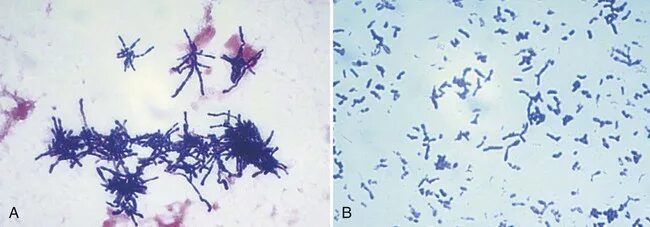 Corynebacterium spp в мазке у мужчин. Листерии в мазке. коринебактерии в мазке у женщин. листерия моноцитогенес под микроскопом по грамму. листерии в мясе.