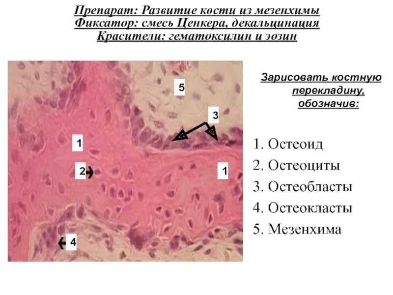 Гистология кратко и понятно. Развитие кости из соединительной ткани (мезенхимы). развитие кости из мезенхимы прямой остеогенез препарат гистология. развитие костной ткани из соединительной ткани(мезенхимы). препарат. грубоволокнистаякостная ткань гистология.