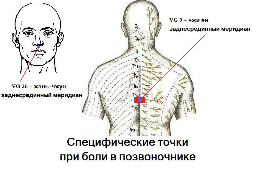 Точки болезненности. Болевые точки на позвоночнике. Болезненные точки на спине. Точки боли в позвоночнике.