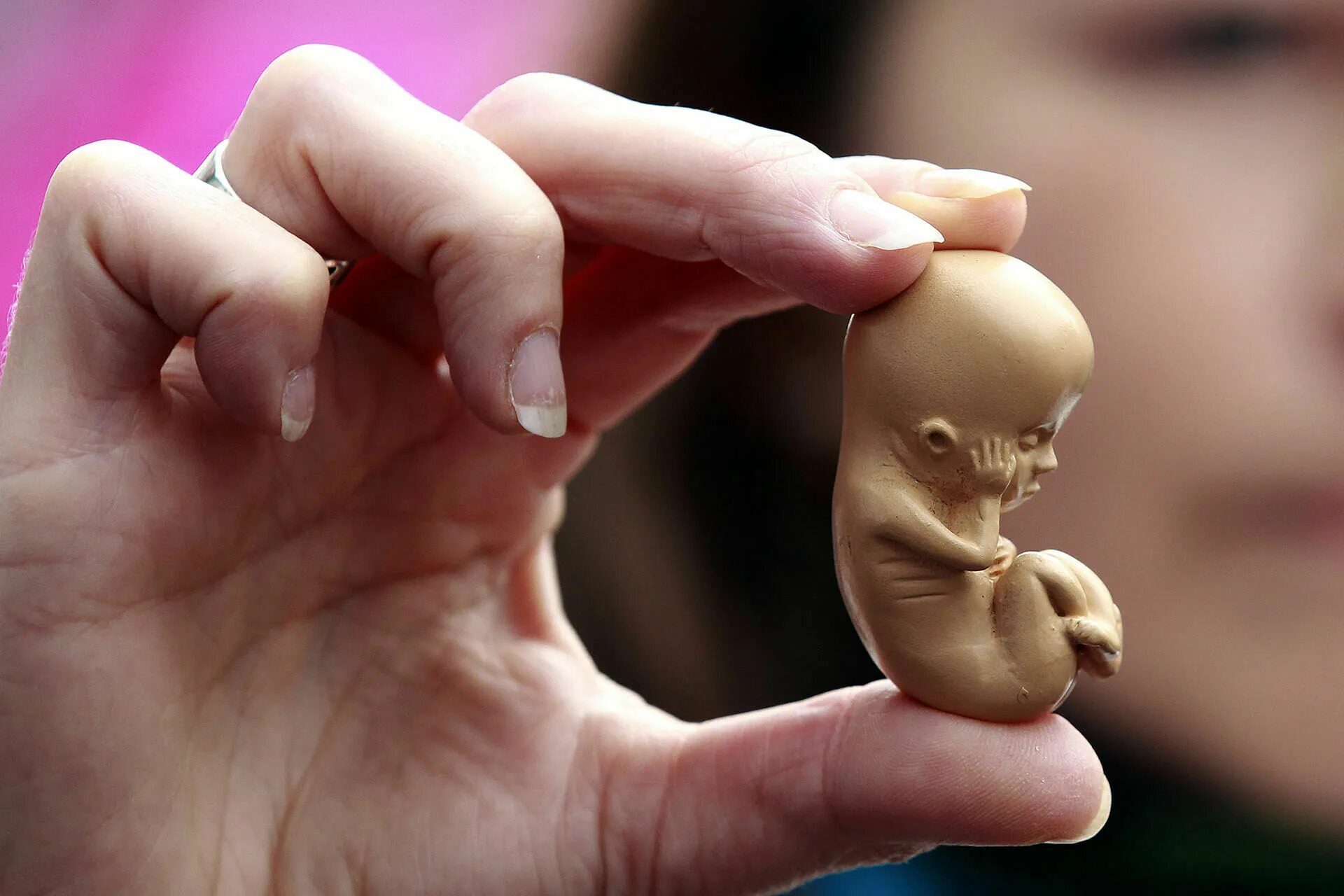 Скрещивание людей дети. Человеческий эмбрион аборт.