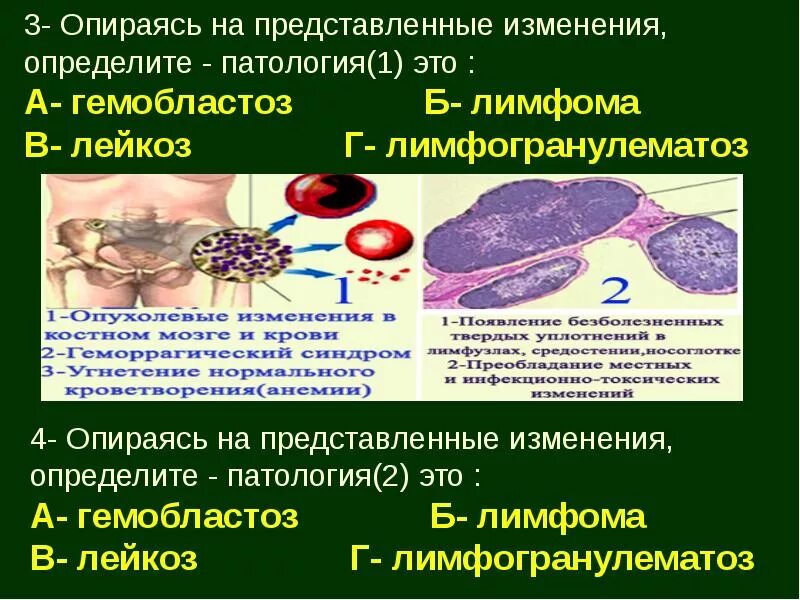 Гемобластозы общая характеристика. Гемобластозы клинико морфологическая. Гемобластозы у детей классификация. Гемобластозы костномозгового происхождения.