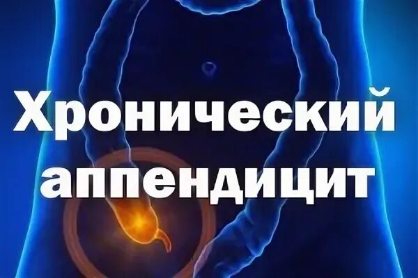 Хронический аппендицит симптомы. Признаки хронического аппендицита. Хронический аппендицит признаки. Патогенез хронического аппендицита. Хронический аппендицит симптомы.