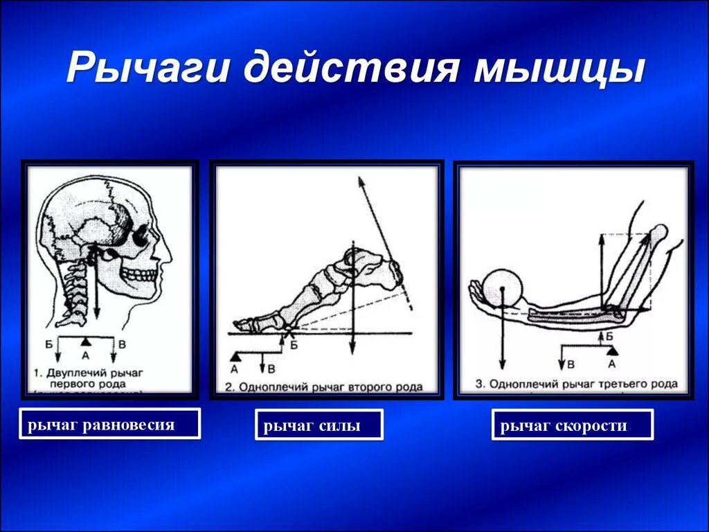 2 рычаг в скелете человека. Биомеханика рычаг силы рычаг скорости. Рычаг 3 рода в биомеханике. Рычаг скорости 2 рода анатомия. Рычаг 2 рода в биомеханике.