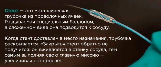 Стенты меняют