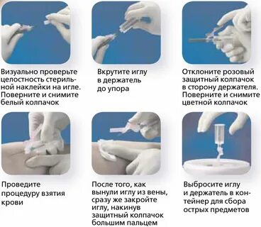 Исследование венозной крови у новорожденных: правильное проведение анализа