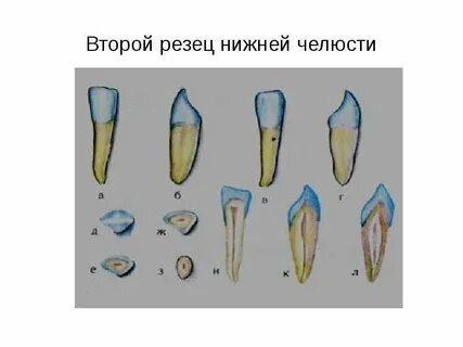 Верхние резцы где