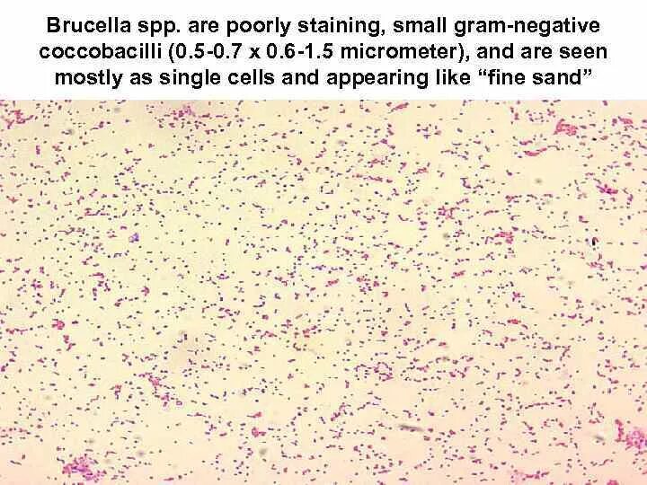 Brucella spp. Brucella spp