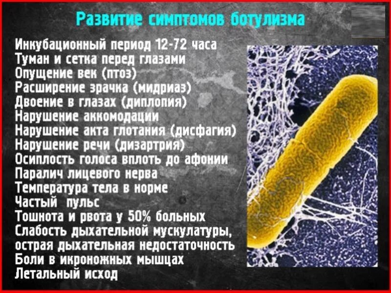 Ботулизм возбудитель симптомы. Ботулизм симптомы. Клинические проявления ботулизма. Симптомы ботулизм отравления.