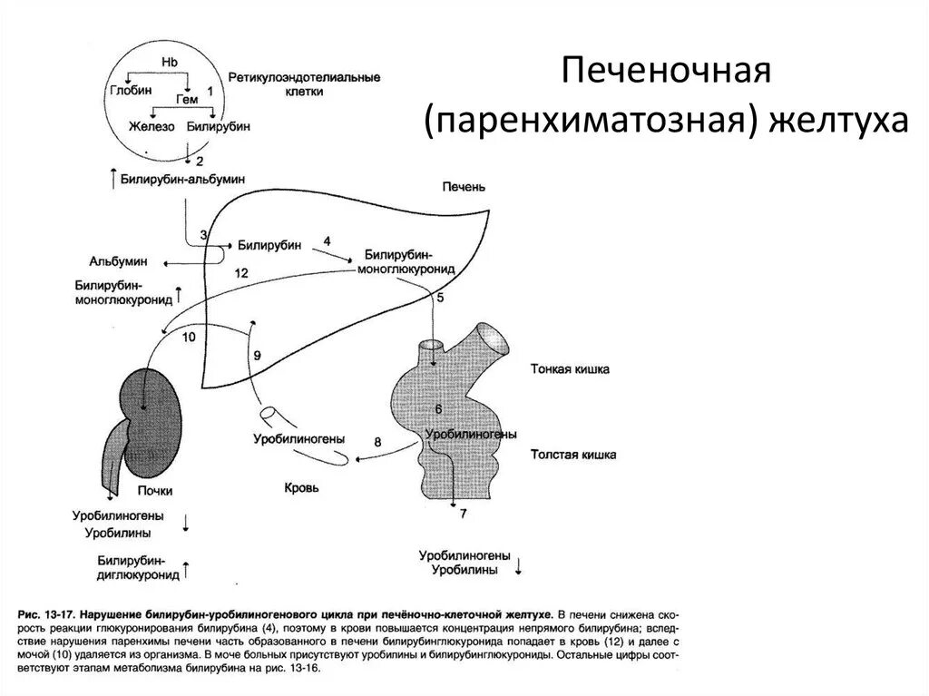 Фракции билирубина при желтухах. Обмен билирубина при паренхиматозной желтухе схема. обмен билирубина при печеночной желтухе. обмен билирубина при механической желтухе схема. обмен билирубина при печеночной желтухе схема.