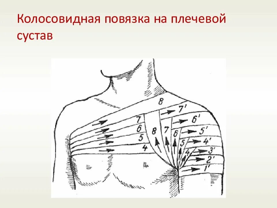 Плечевая повязка алгоритм. Наложение колосовидной повязки на плечевой сустав. Колосовидная повязка на плечо техника. Техника наложения колосовидной повязки на плечо. Перевязка колосовидная на плечо.