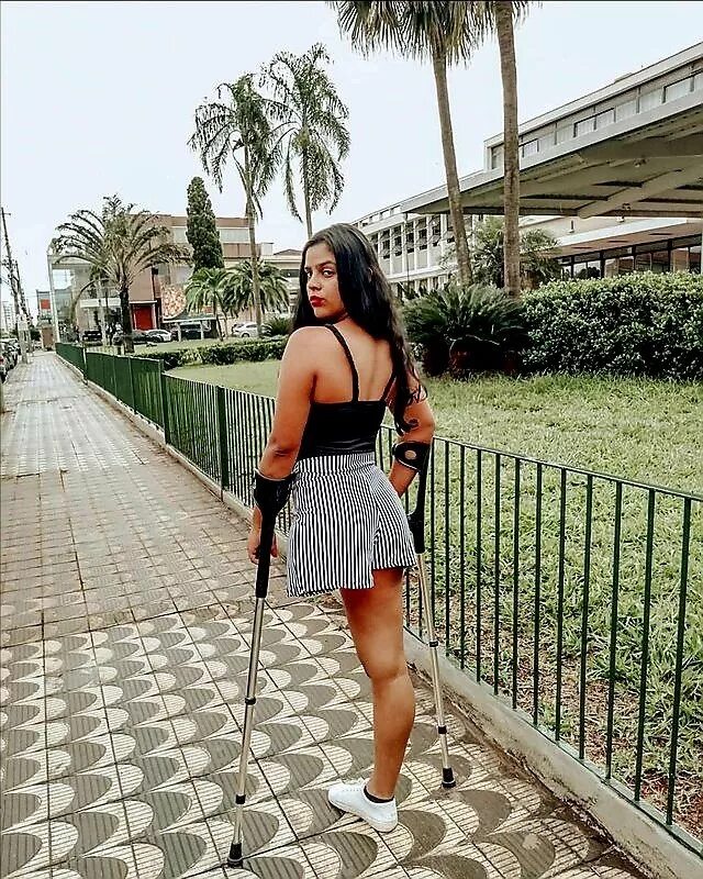 Красивые девушки с протезами. Девушка обнимает другую девушку. Безногая фотомодель. Утешил одноногую девушку. Одноногая ампути на костылях.