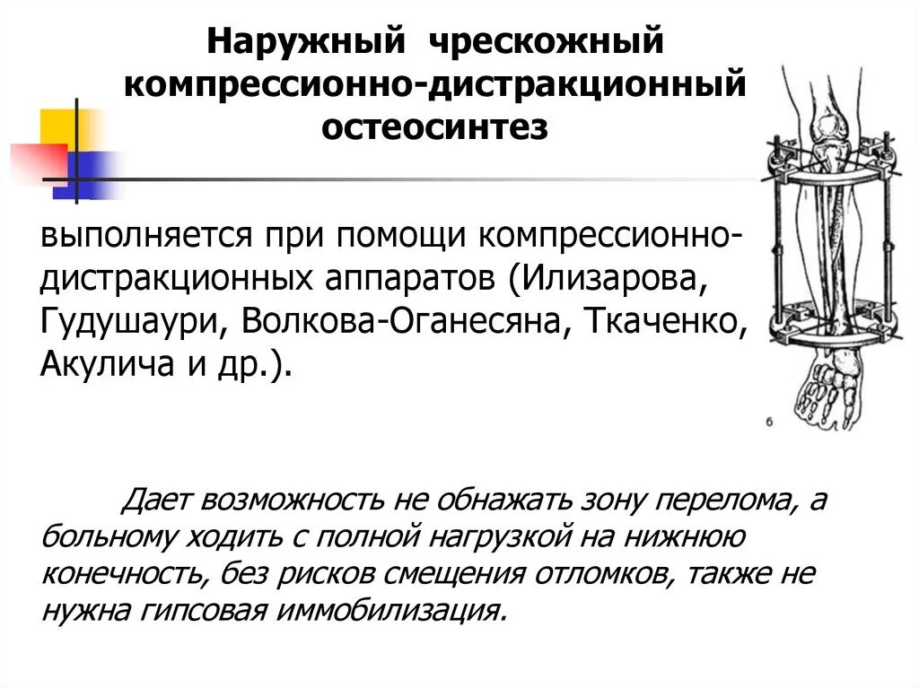Дистракционная остеосинтез. Компрессионно-дистракционный остеосинтез аппараты. Чрескостный компрессионный остеосинтез. Внеочаговый (компрессионно-дистракционный, чрескостный) остеосинтез. Чрескостный остеосинтез аппаратом илизарова.