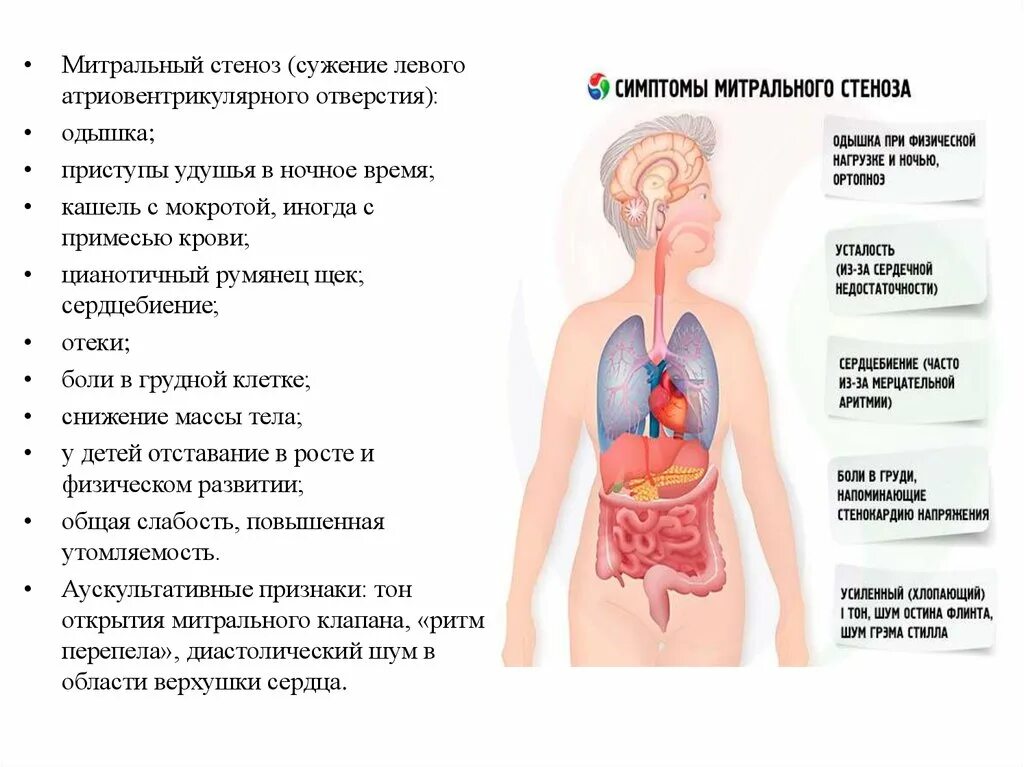 Кашель глубокий грудной с мокротой. Митральный стеноз одышка. Стеноз левого атриовентрикулярного отверстия симптомы. Кашель одышка боль в грудной клетке.