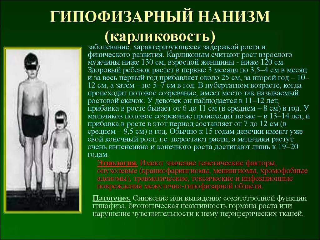 Синдром гипофиза. Карликовость нарушение гипофиза. Гипофизарная карликовость симптомы. Гипофизарный нанизм (карликовость).