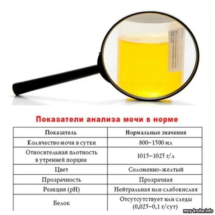 За сколько часов до сдачи мочи. Общий анализ мочи мл. Сколько нужно мочи для общего анализа. Сколько мочи надо для общего анализа мочи. Необходимый объем мочи для анализа.