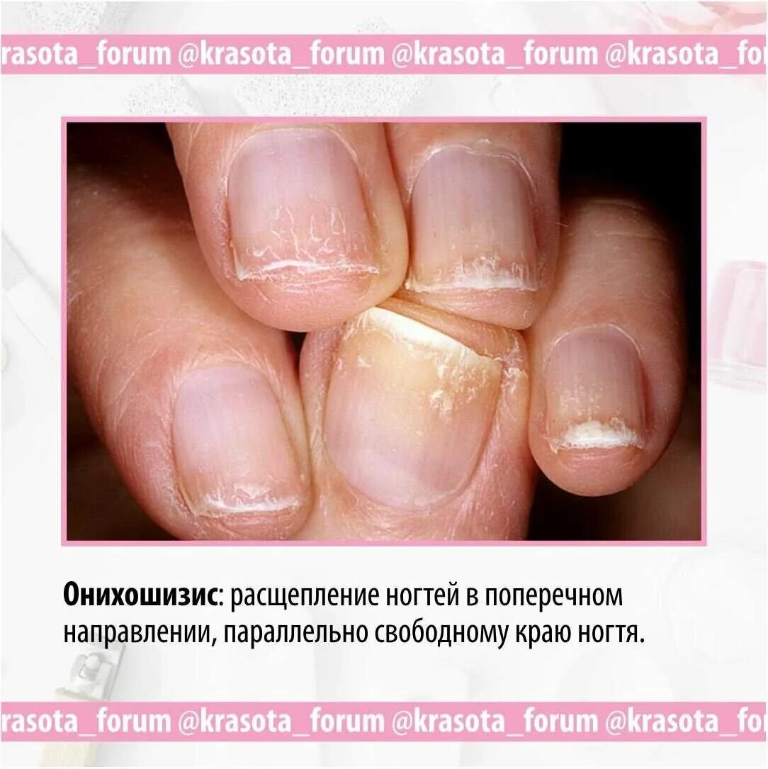 Доктор по ногтям как называется