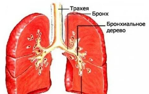 Трахеидный кашель лечение