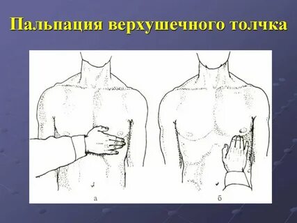 Дрожание грудины