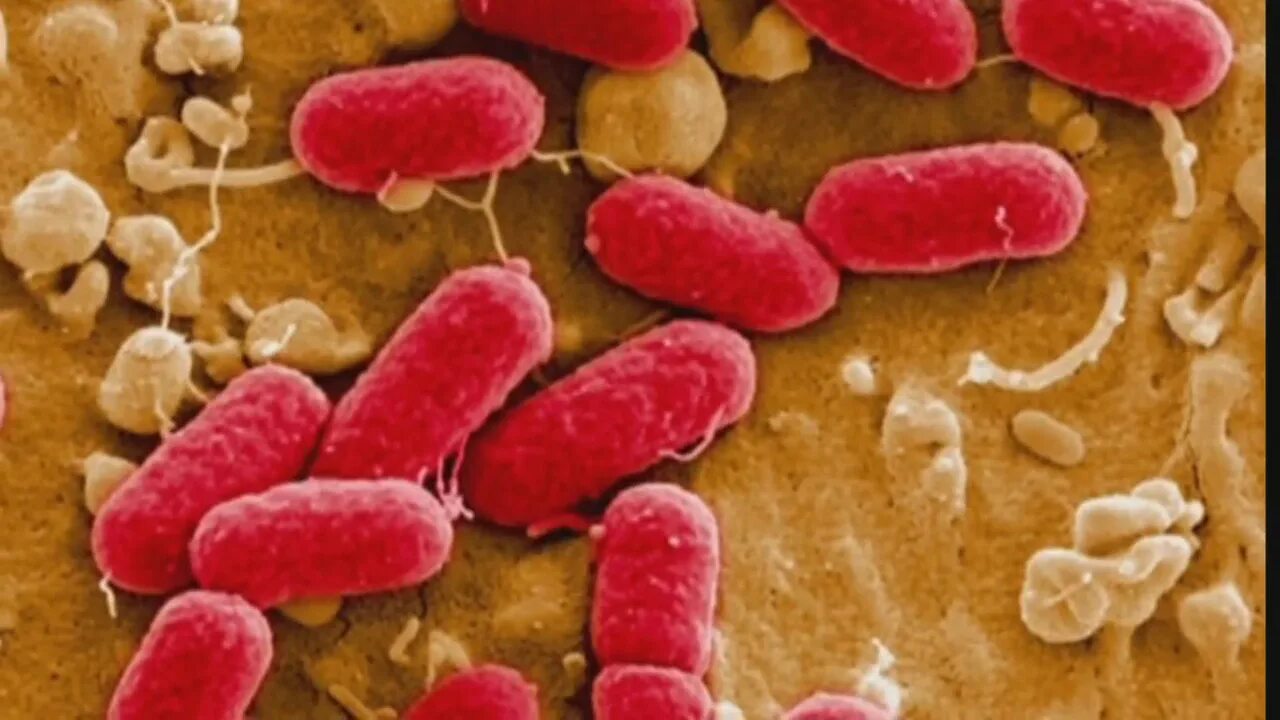 кишечная палочка анаэроб. эшерихии группа бактерий. бактерия escherichia coli. бактерия escherichia coli. кишечная палочка морфология.