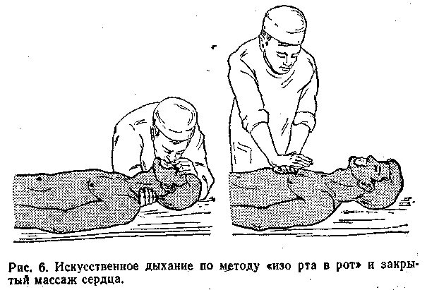 Искусственное дыхание первая помощь и массаж. Методика искусственного дыхания. искусственное дыхание и наружный массаж сердца. оказание первой медицинской помощи искусственное дыхание.