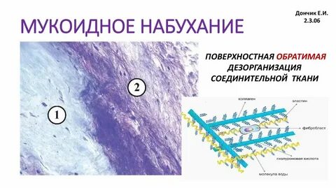 Мукоидное набухание это