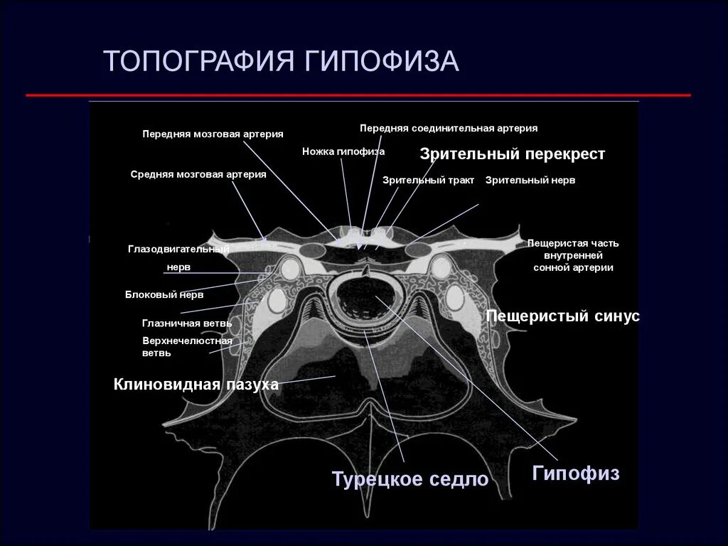 Артерии гипофиза. Кавернозный синус мрт анатомия. Пещеристый синус турецкое седло. Топография гипофиза.