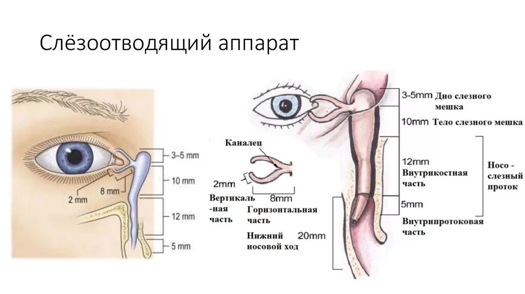 Слезный аппарат дакриоцистит. Дакриоцистит анатомия. Массаж при непроходимости слезного канала схема. Слезный проток мешок канальца.