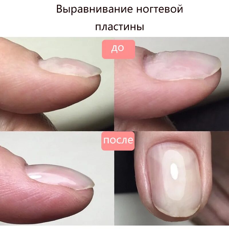 Отслаивается полигель