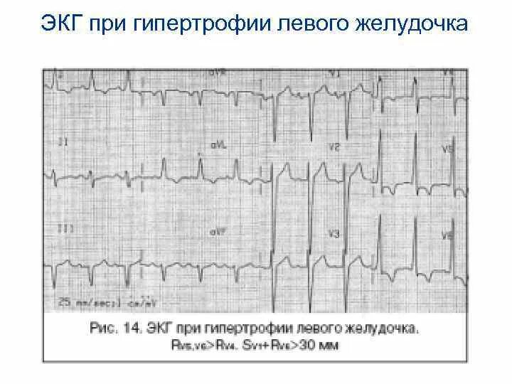 Смещение st вверх v4 v5