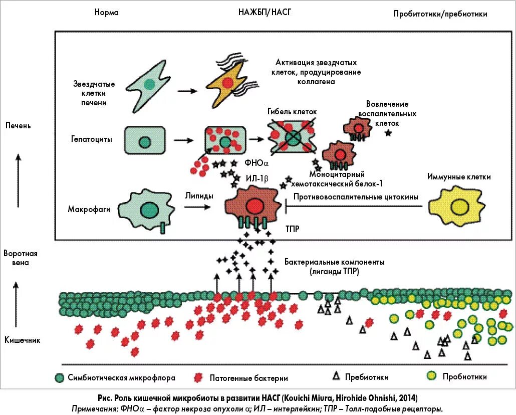 Количество клеток печени. НАЖБП этиология. Неалкогольная жировая болезнь печени этиология. Неалкогольная болезнь печени патогенез. Кишечная микробиота и НАЖБП.