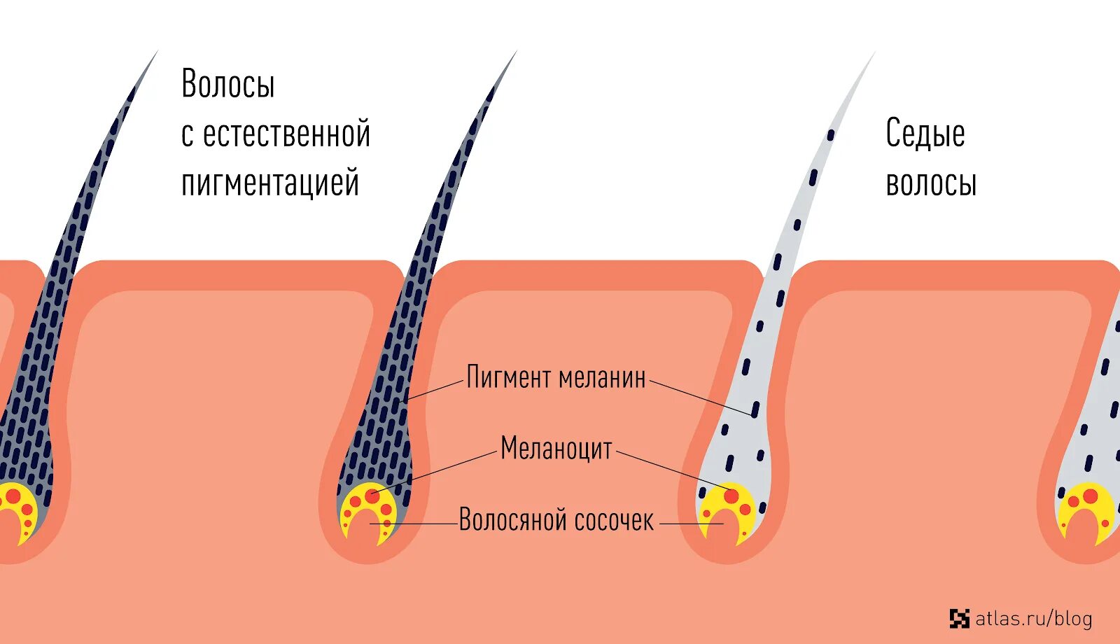 Эумеланин и феомеланин. Эумеланин и феомеланин пигмент волоса. Строение волоса меланин. Строение Седого волоса.